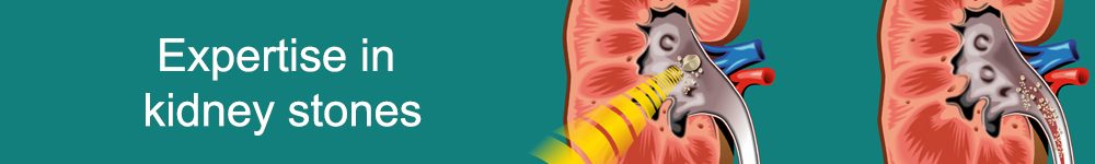 banner - kidney stones